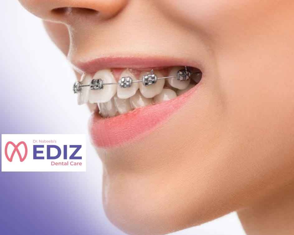 EDIZ DENTAL CARE